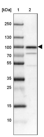 SSRP1 Antibody in Western Blot (WB)