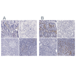 IRF4 Polyclonal Antibody