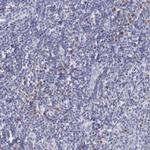 IRF4 Antibody in Immunohistochemistry (Paraffin) (IHC (P))