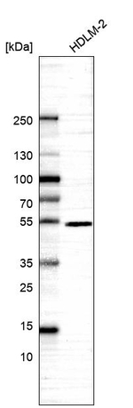 IRF4 Antibody in Western Blot (WB)
