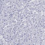 Thyroglobulin Antibody in Immunohistochemistry (Paraffin) (IHC (P))