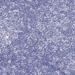 Thyroglobulin Antibody in Immunohistochemistry (Paraffin) (IHC (P))