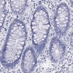 Thyroglobulin Antibody in Immunohistochemistry (Paraffin) (IHC (P))