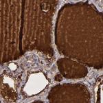 Thyroglobulin Antibody in Immunohistochemistry (Paraffin) (IHC (P))