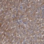 SERPINA7 Polyclonal Antibody