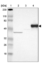 SERPINA7 Antibody in Western Blot (WB)