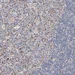 UQCRC1 Polyclonal Antibody