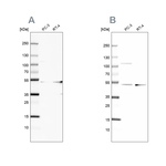 UQCRC1 Antibody in Western Blot (WB)