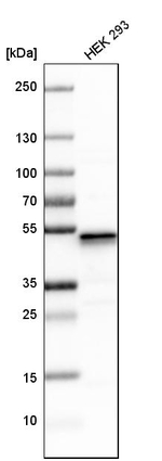 UQCRC1 Antibody in Western Blot (WB)