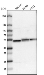 UQCRC1 Antibody in Western Blot (WB)