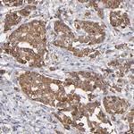 PGRMC1 Antibody in Immunohistochemistry (Paraffin) (IHC (P))