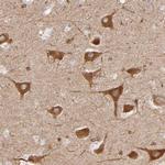 PGRMC1 Antibody in Immunohistochemistry (Paraffin) (IHC (P))