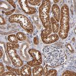 PGRMC1 Antibody in Immunohistochemistry (Paraffin) (IHC (P))