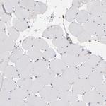 PGRMC1 Antibody in Immunohistochemistry (Paraffin) (IHC (P))