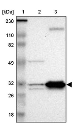 ECH1 Antibody in Western Blot (WB)