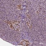 p57 Kip2 Antibody in Immunohistochemistry (Paraffin) (IHC (P))