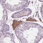 p57 Kip2 Antibody in Immunohistochemistry (Paraffin) (IHC (P))