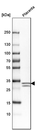 p57 Kip2 Antibody in Western Blot (WB)