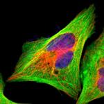 Filamin A Polyclonal Antibody