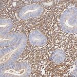 Filamin A Antibody in Immunohistochemistry (Paraffin) (IHC (P))