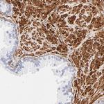 Filamin A Antibody in Immunohistochemistry (Paraffin) (IHC (P))
