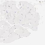 Filamin A Antibody in Immunohistochemistry (Paraffin) (IHC (P))
