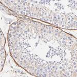 Filamin A Antibody in Immunohistochemistry (Paraffin) (IHC (P))