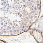 Filamin A Antibody in Immunohistochemistry (Paraffin) (IHC (P))