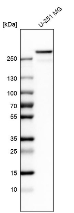 Filamin A Antibody in Western Blot (WB)