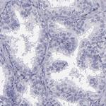C/EBP epsilon Antibody in Immunohistochemistry (Paraffin) (IHC (P))