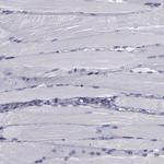 C/EBP epsilon Antibody in Immunohistochemistry (Paraffin) (IHC (P))