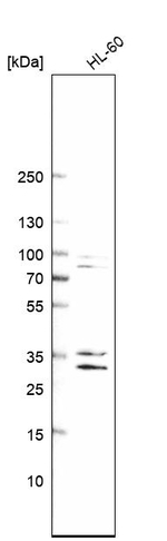 C/EBP epsilon Antibody in Western Blot (WB)