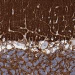 CADM3 Antibody in Immunohistochemistry (Paraffin) (IHC (P))