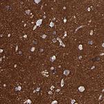 CADM3 Antibody in Immunohistochemistry (Paraffin) (IHC (P))