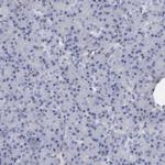 CADM3 Antibody in Immunohistochemistry (Paraffin) (IHC (P))