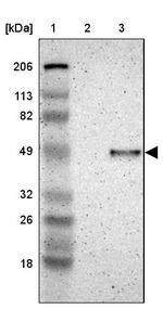 CADM3 Antibody in Western Blot (WB)