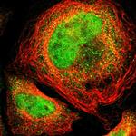 Thrombomodulin Polyclonal Antibody