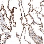 Thrombomodulin Antibody in Immunohistochemistry (Paraffin) (IHC (P))