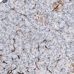 Thrombomodulin Antibody in Immunohistochemistry (Paraffin) (IHC (P))