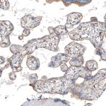 Thrombomodulin Antibody in Immunohistochemistry (Paraffin) (IHC (P))