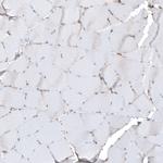 Thrombomodulin Antibody in Immunohistochemistry (Paraffin) (IHC (P))