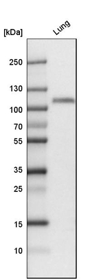 Thrombomodulin Antibody in Western Blot (WB)