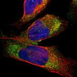 Cathepsin S Polyclonal Antibody