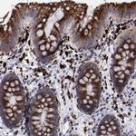 Cathepsin S Antibody in Immunohistochemistry (Paraffin) (IHC (P))