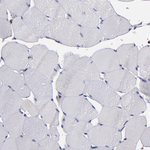 Cathepsin S Antibody in Immunohistochemistry (Paraffin) (IHC (P))