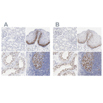 NCAPH Antibody in Immunohistochemistry (Paraffin) (IHC (P))
