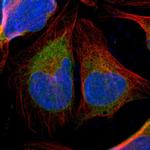 TMX Polyclonal Antibody