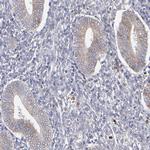 TMX Antibody in Immunohistochemistry (Paraffin) (IHC (P))