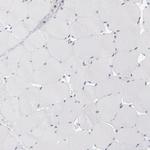 TMX Antibody in Immunohistochemistry (Paraffin) (IHC (P))