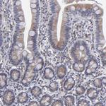 TMX Antibody in Immunohistochemistry (Paraffin) (IHC (P))
